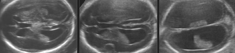 Featured image of post Ενδείξεις